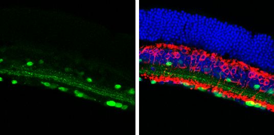 Calretinin Rabbit Polyclonal Antibody