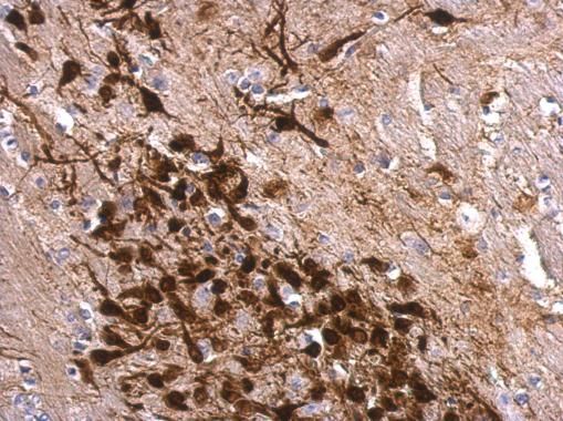 Calretinin Rabbit Polyclonal Antibody