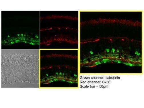 Calretinin Rabbit Polyclonal Antibody