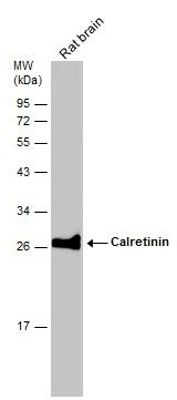 Calretinin Rabbit Polyclonal Antibody