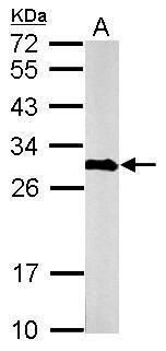 Calretinin Rabbit Polyclonal Antibody