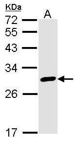 Calretinin Rabbit Polyclonal Antibody