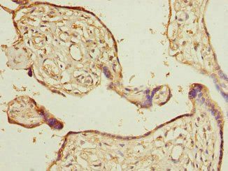 CALU Antibody