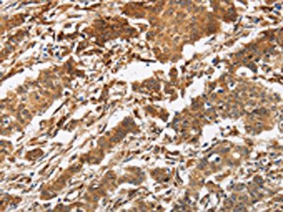 CALU Antibody