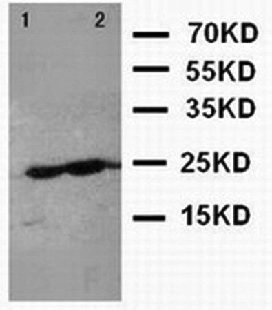 Canstatin Rabbit Polyclonal Antibody