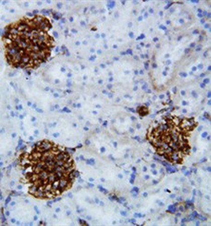 Canstatin Rabbit Polyclonal Antibody