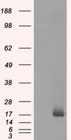 Cardiac Troponin I Antibody
