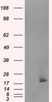 Cardiac Troponin I Antibody