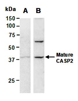 CASP2 (vPairTM) Antibodies