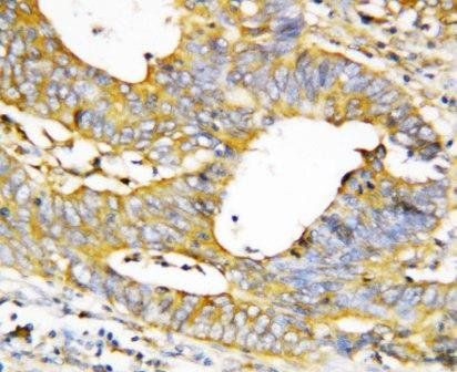 Caspase-1/CASP1 Rabbit Polyclonal Antibody