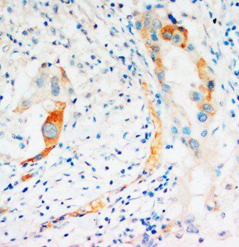 Caspase-2/CASP2 Rabbit Polyclonal Antibody