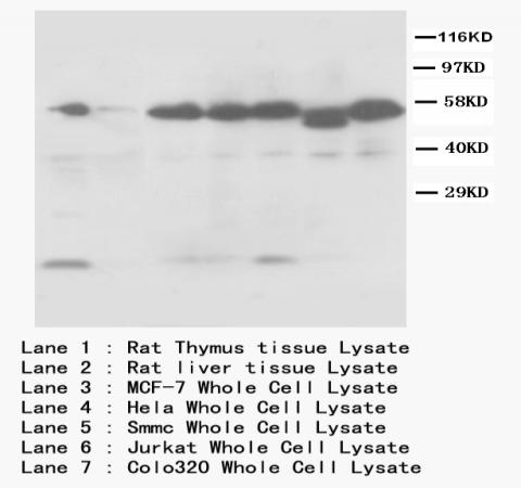 Caspase-8/CASP8 Rabbit Polyclonal Antibody