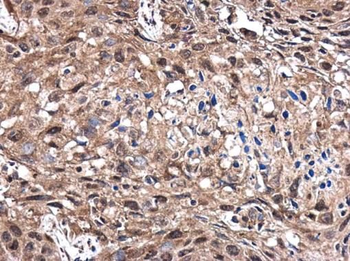 CD1b Rabbit Polyclonal Antibody