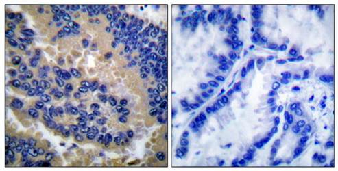 Caspase-3 Research Tools