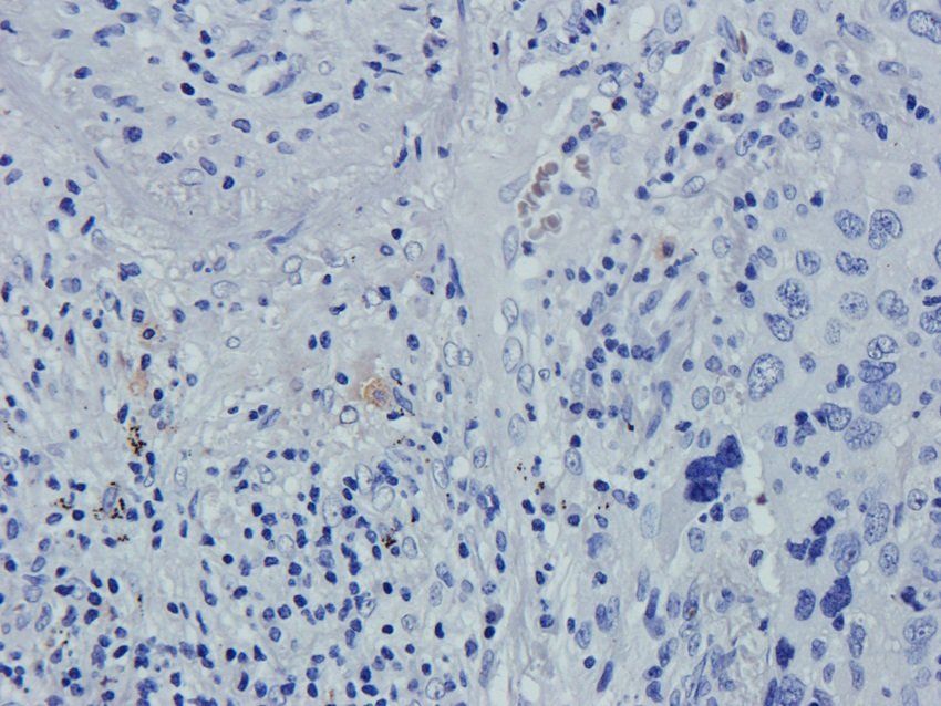 Caspase 3 Rabbit Polyclonal Antibody