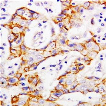 beta Catenin/CTNNB1 Rabbit Polyclonal Antibody