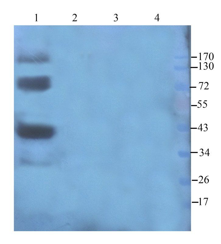 Cathepsin G Rabbit Polyclonal Antibody