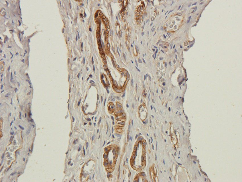 Caveolin 1 Rabbit Polyclonal Antibody
