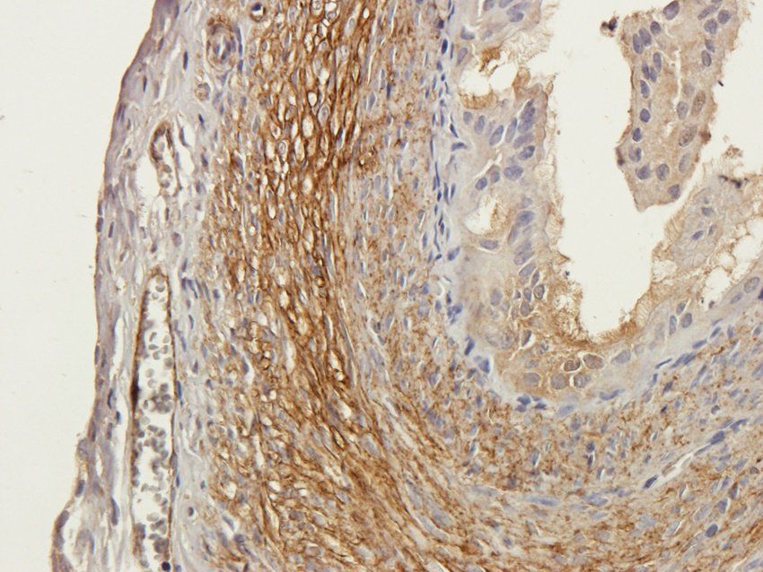 Caveolin 1 Rabbit Polyclonal Antibody