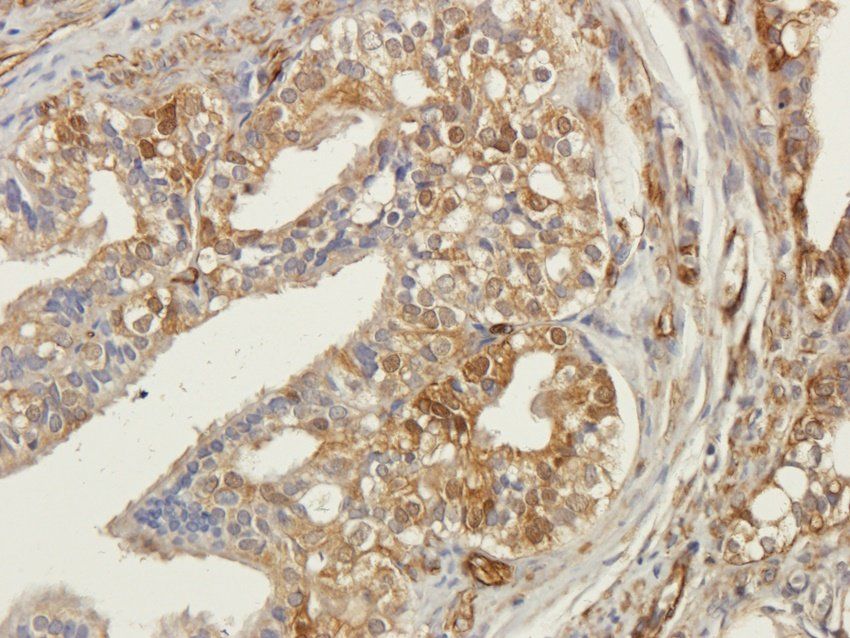 Caveolin 1 Rabbit Polyclonal Antibody