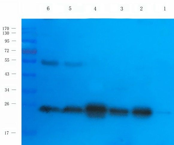 Caveolin 1 Rabbit Polyclonal Antibody