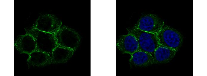 Caveolin 2 Rabbit Polyclonal Antibody