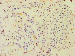 CBLC Antibody