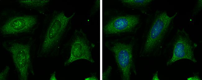 CBS Rabbit Polyclonal Antibody