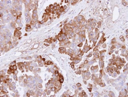 CBS Rabbit Polyclonal Antibody
