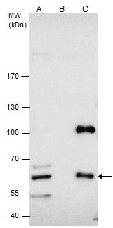 CBS Rabbit Polyclonal Antibody