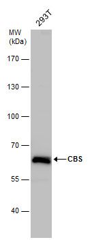 CBS Rabbit Polyclonal Antibody