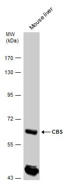 CBS Rabbit Polyclonal Antibody