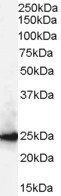 CBX1/HP1-Beta Antibody
