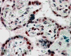 CBX1/HP1-Beta Antibody