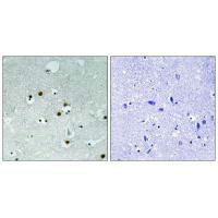 CBX5 Antibody