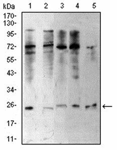 CBX5 Antibody
