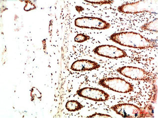CBX5 Antibody