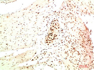 CBX5 Antibody