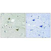 CCDC88A Antibody