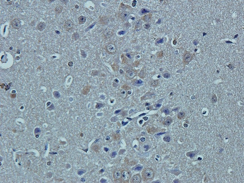 CCKN Rabbit Polyclonal Antibody
