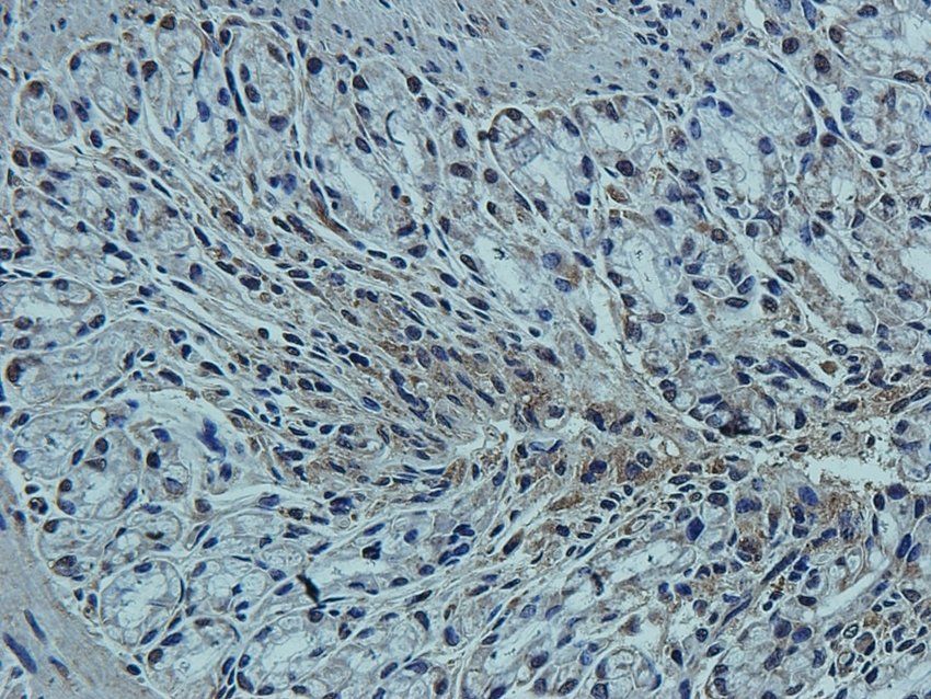 CCKN Rabbit Polyclonal Antibody