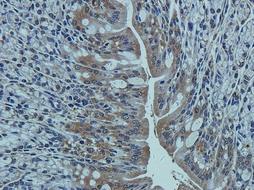CCKN Rabbit Polyclonal Antibody