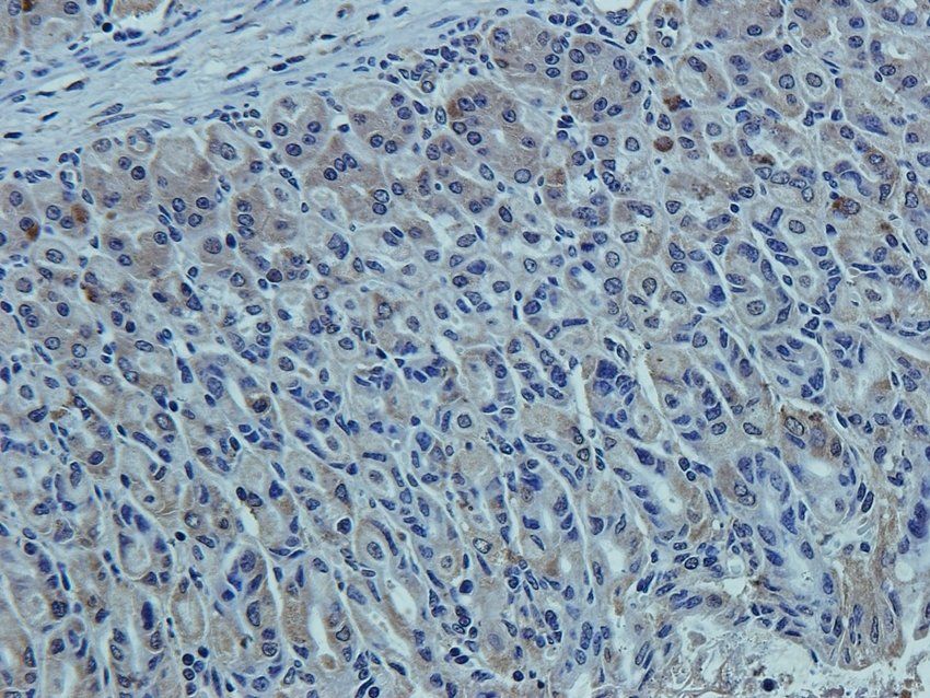 CCKN Rabbit Polyclonal Antibody