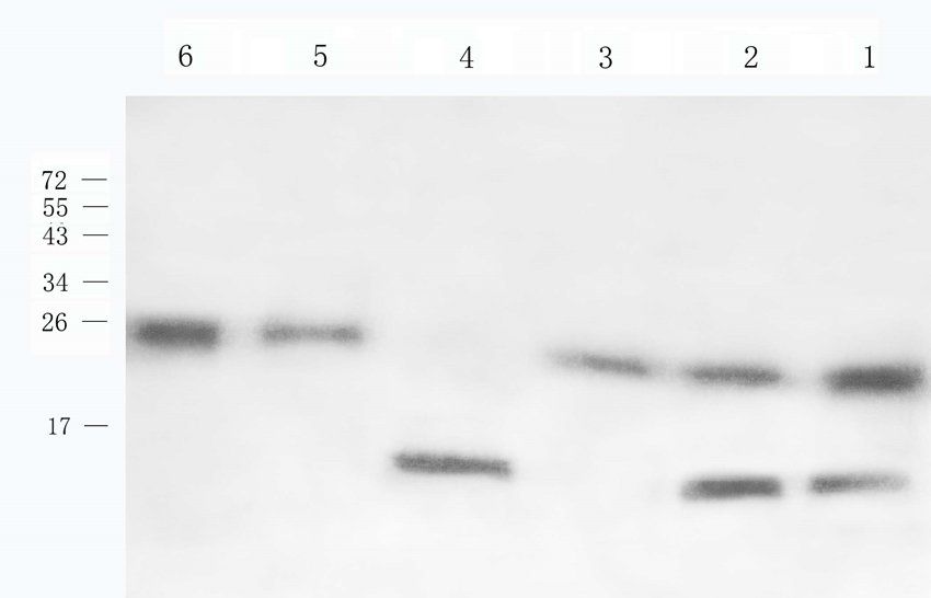 CCKN Rabbit Polyclonal Antibody