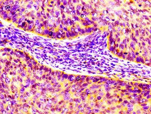CCL17 Antibody