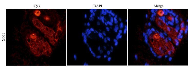 MCP1 Rabbit Polyclonal Antibody