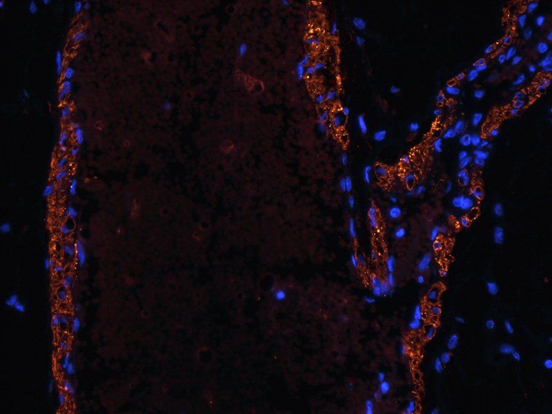 MCP1 Rabbit Polyclonal Antibody