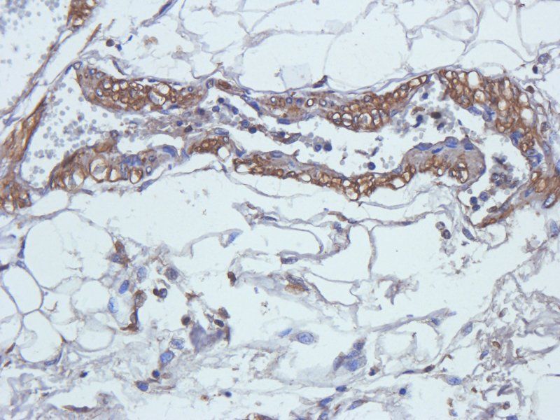 MCP1 Rabbit Polyclonal Antibody