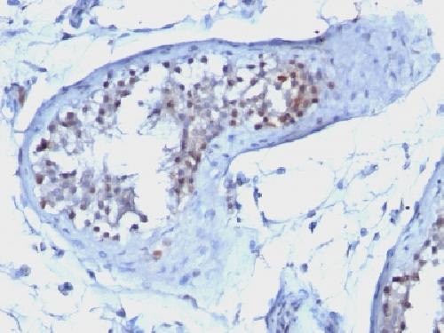 CCNB1 Antibody