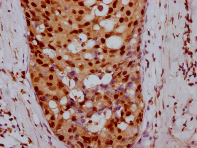 CCNE1 Antibody